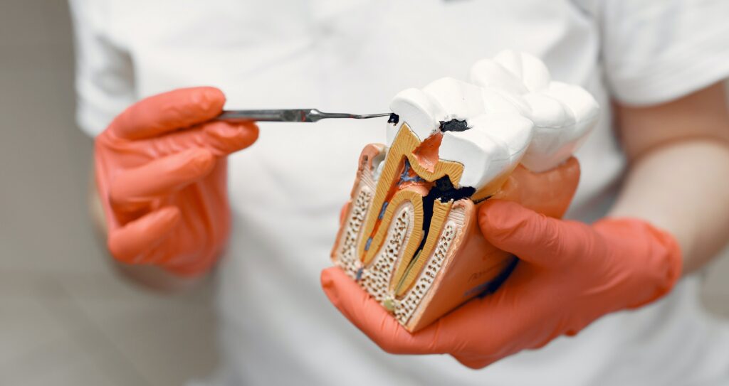 Dentist Holding a Tooth Model and a Dental Tool